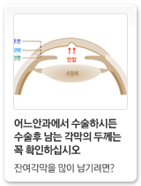 각막의두께 중요성