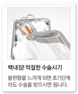 백내장!적절한 수술시기