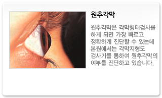 원추각막