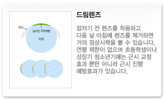 드림렌즈